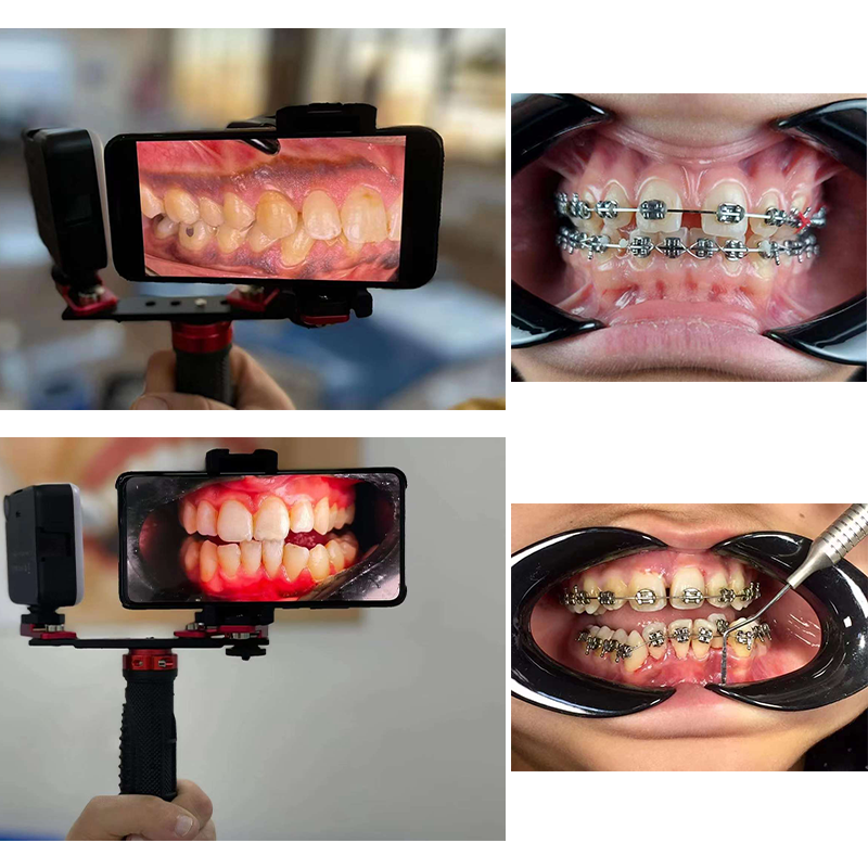 Dentistry Material Mobile Phon – Photography Lighting Led recenzja i cena