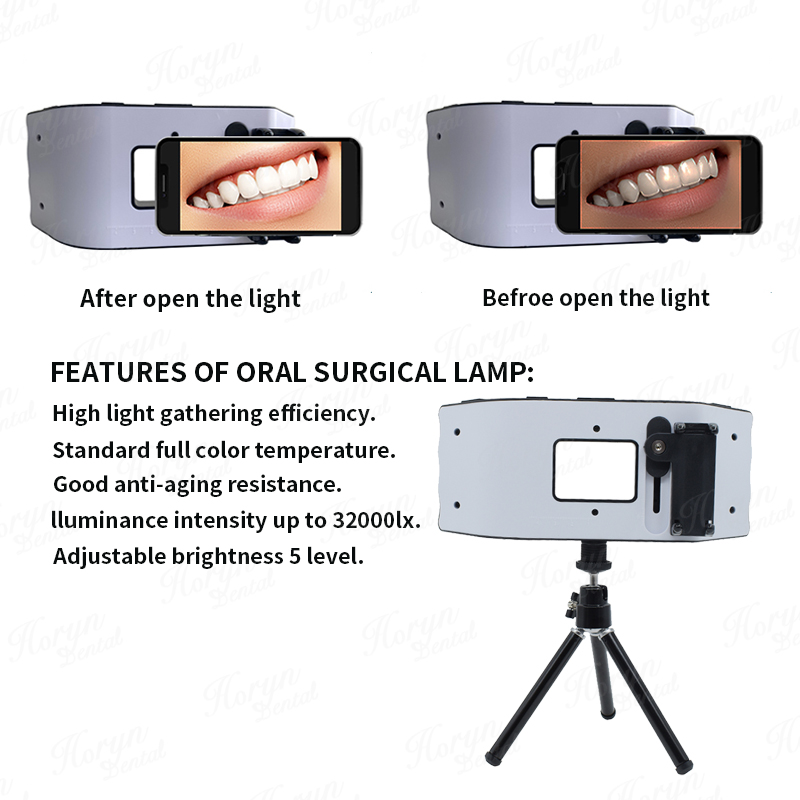 Dental Flash Light Photography – Photography Lighting Led recenzja i cena